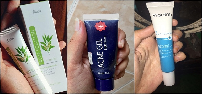 Mau Atasi Jerawat? 7 Acne Spot Treatment Lokal ini Rekomendasi Banget!